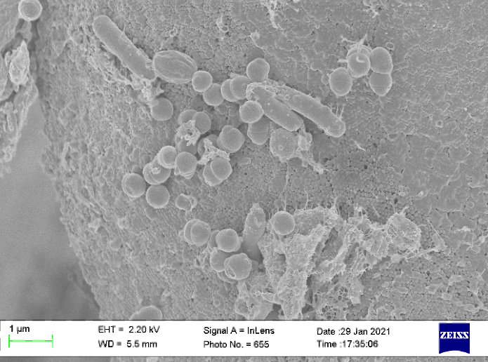 Cryo-SEM micrograph of cells on a surface